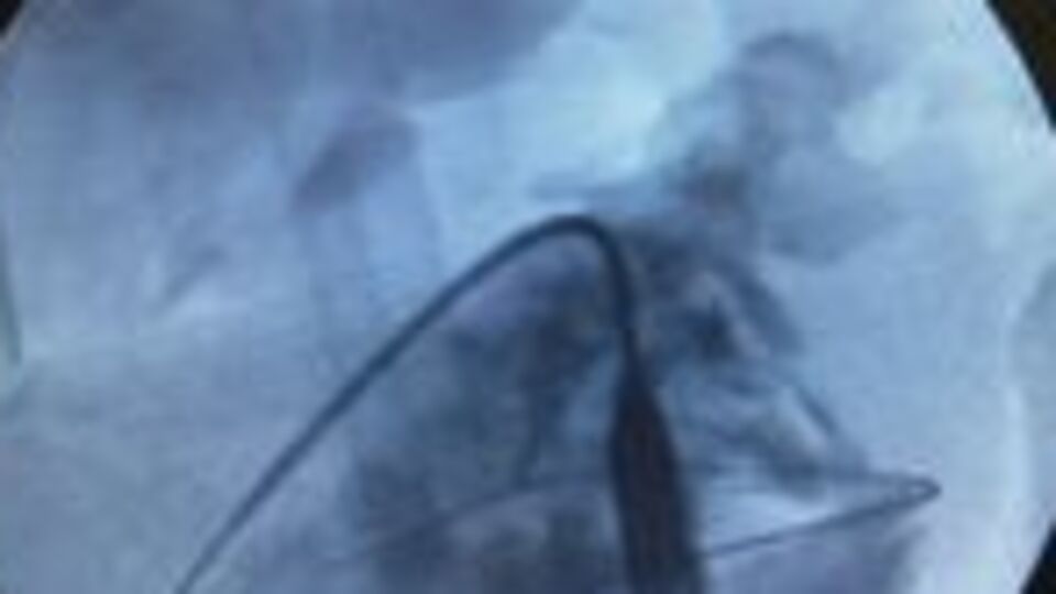 Bu ameliyat Türkiye'de bir ilk!