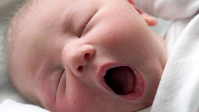 Epidural ile normal doğum