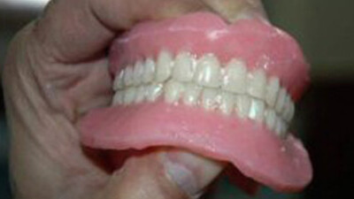 Uyurken takma dişlerini yuttu