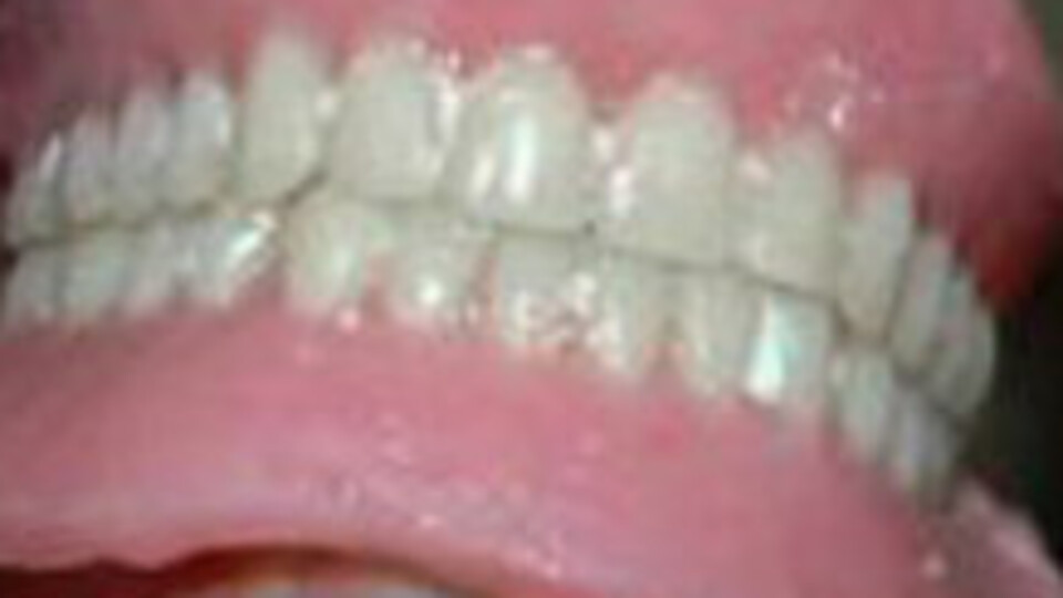 Uyurken takma dişlerini yuttu