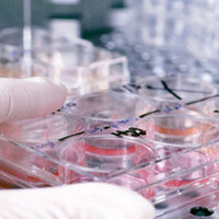 Ölümlerin yarısı bu hastalıktan!