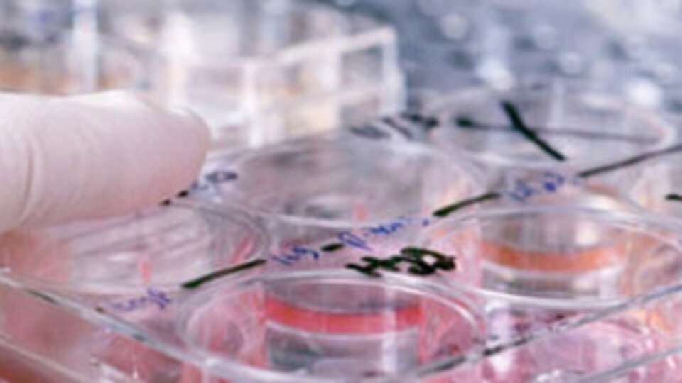 Ölümlerin yarısı bu hastalıktan!