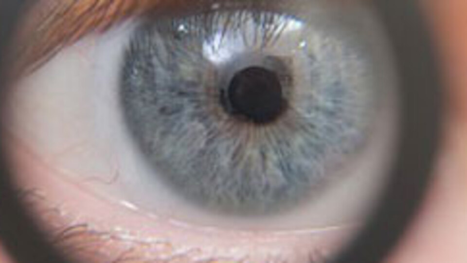 Artık gözden teşhis edilecek