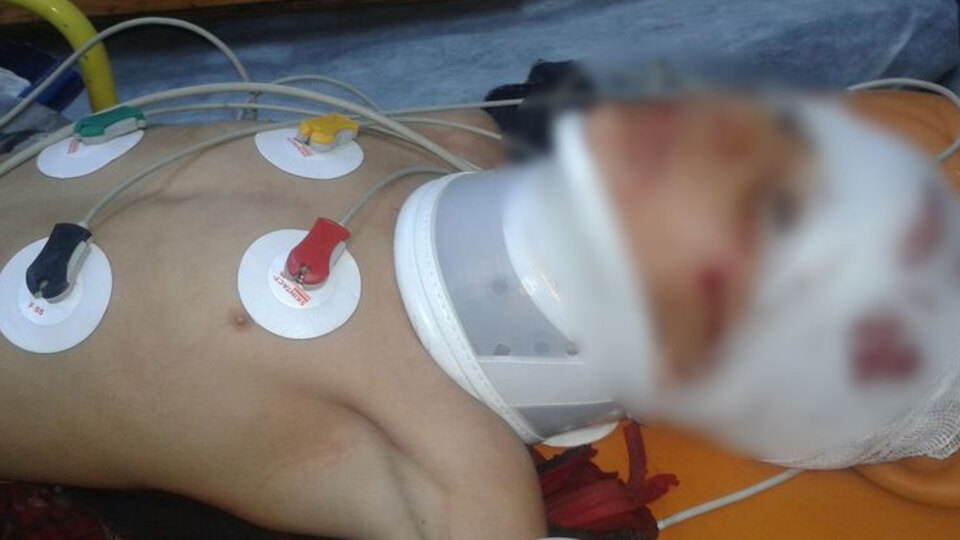 İkinci 'Berkin' olayında önemli gelişme