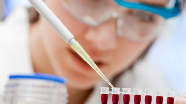 Hepatit C'de tam iyileşme mümkün