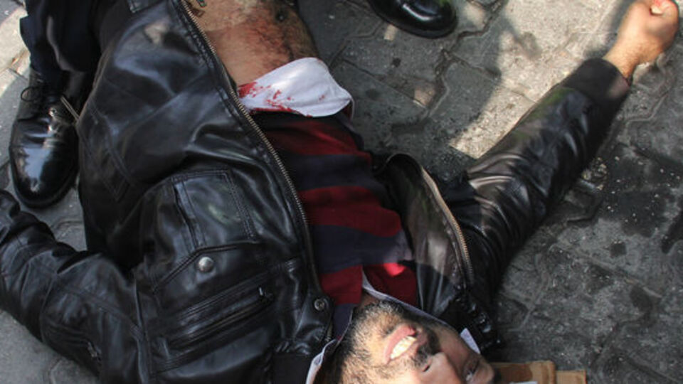 Dayakçı sevgilisini bıçakladı!