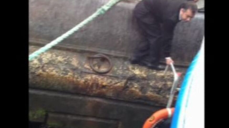 Ahmet bebeğin doktorundan önemli açıklama