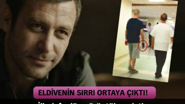 İşte eldivenin sırrı