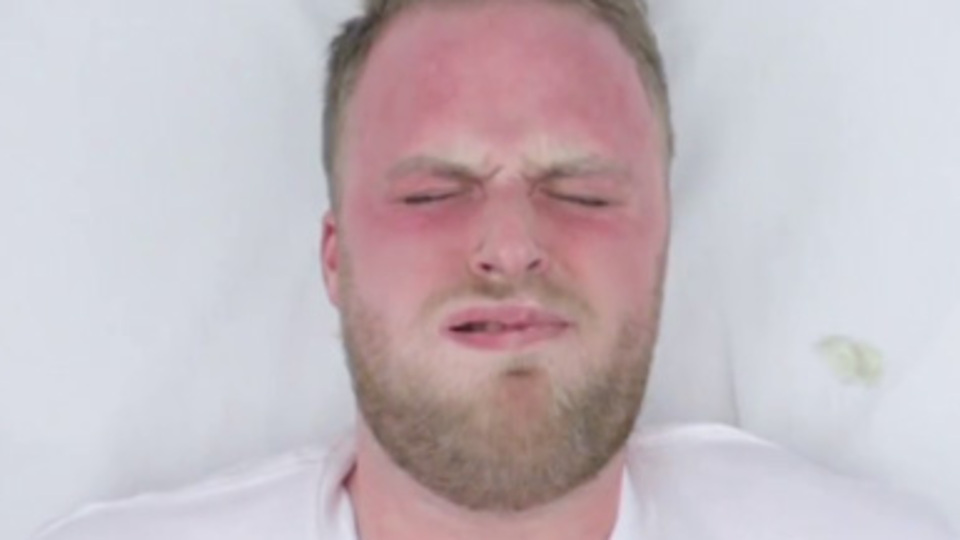 Testis kanserine dikkat çekmek için 'acı' çektiler