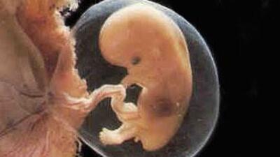 Gebelikte 8. Hafta (Hamilelik) Gebeliğin 8. haftasında neler oluyor?