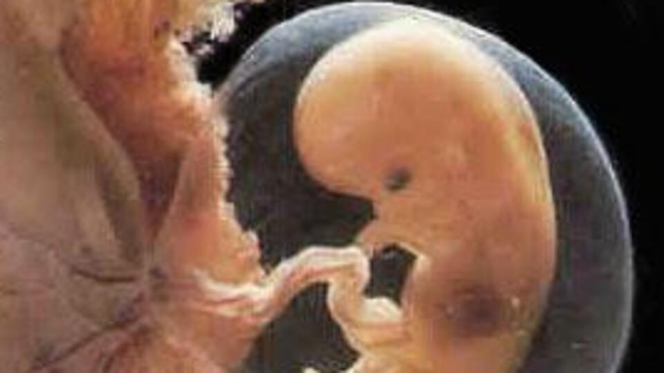 Gebelikte 8. Hafta (Hamilelik) Gebeliğin 8. haftasında neler oluyor?