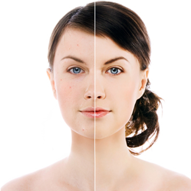 6 soruda anti-aging