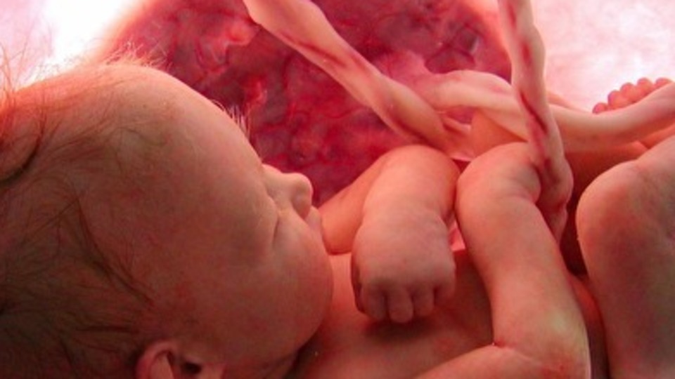 Sakat çocuk riski sıfırlanabilir