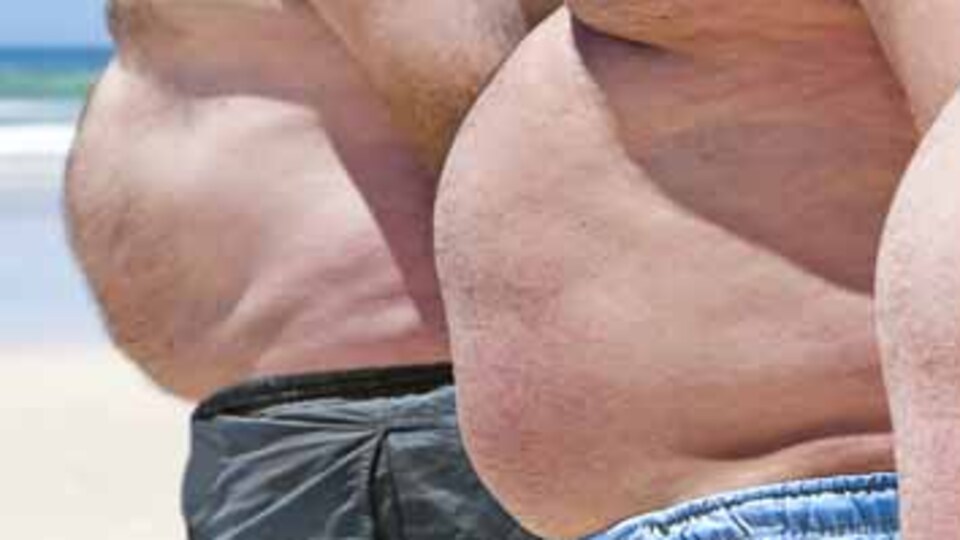 Türkiye'de obezite alarmı!