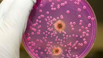 Hastalıkların sebebi: Candida mantarı