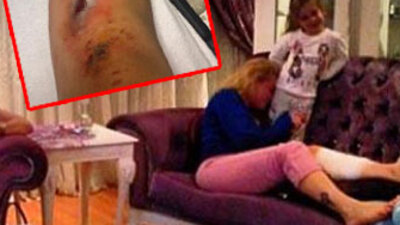 'Gözü değenin gözü çıksın'