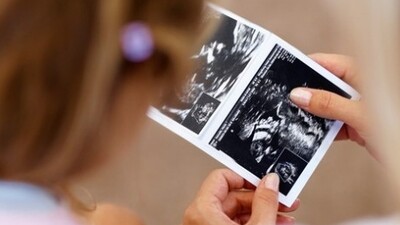 Gebelikte 13. Hafta (Hamilelik) Gebeliğin 13.haftasında neler oluyor?