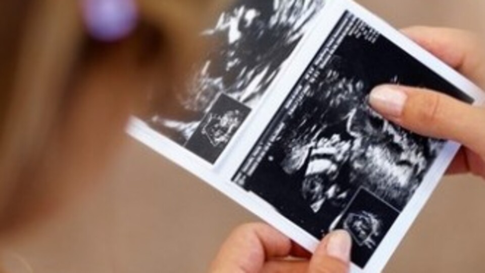 Gebelikte 13. Hafta (Hamilelik) Gebeliğin 13.haftasında neler oluyor?