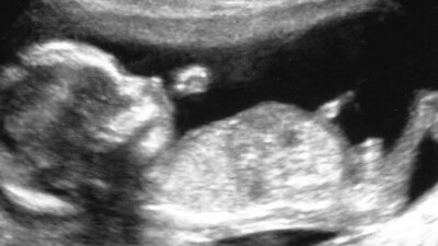 Gebelikte 14. Hafta (Hamilelik) Gebeliğin 14. haftasında neler oluyor?