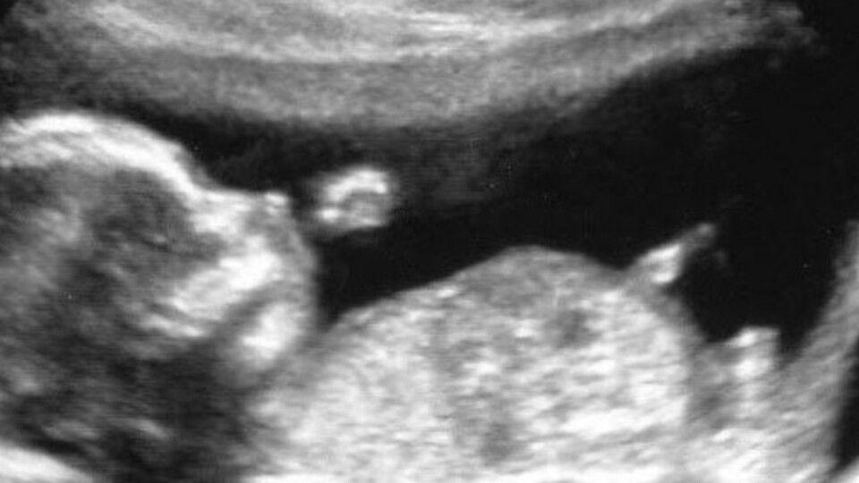 Gebelikte 14. Hafta (Hamilelik) Gebeliğin 14. haftasında neler oluyor?