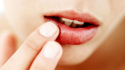 Uçuklarla başınız dertteyse dikkat!