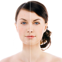 'Vampir terapisi' ne kadar gerçek?