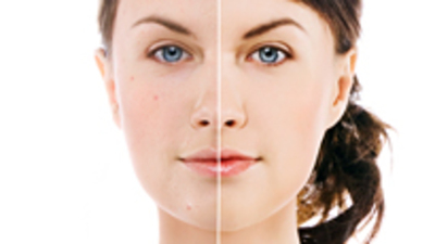 'Vampir terapisi' ne kadar gerçek?