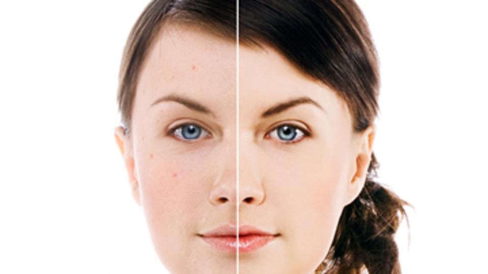 'Vampir terapisi' ne kadar gerçek?