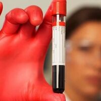 Çocuğunuz 'Talasemi' olmasın!