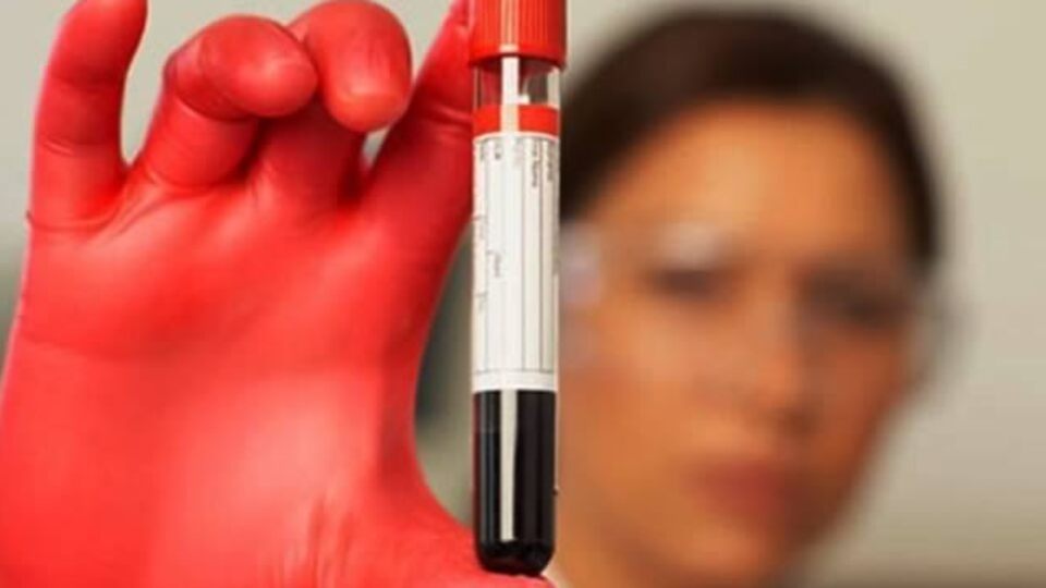 Çocuğunuz 'Talasemi' olmasın!