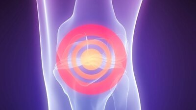 Kırıklar jet hızıyla iyileşecek