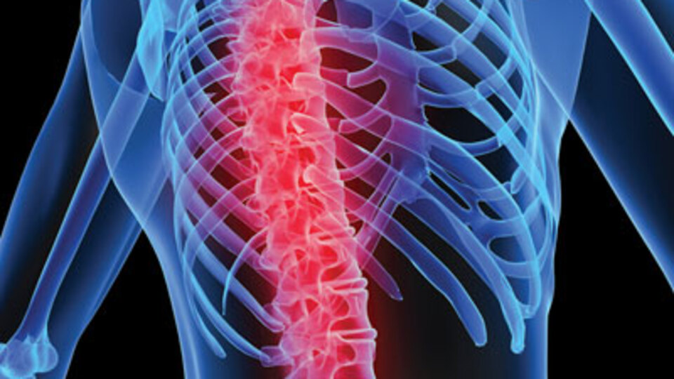 73 yaşındaki hastaya yapay omurga