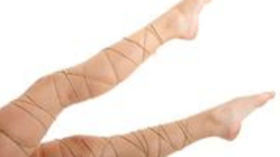 Meslek hastalığı: Varis