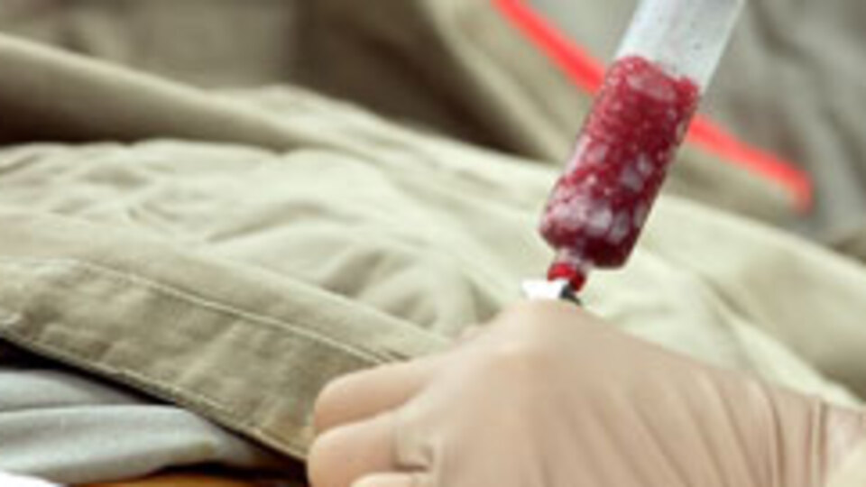 İlik naklinde yeni düzenleme