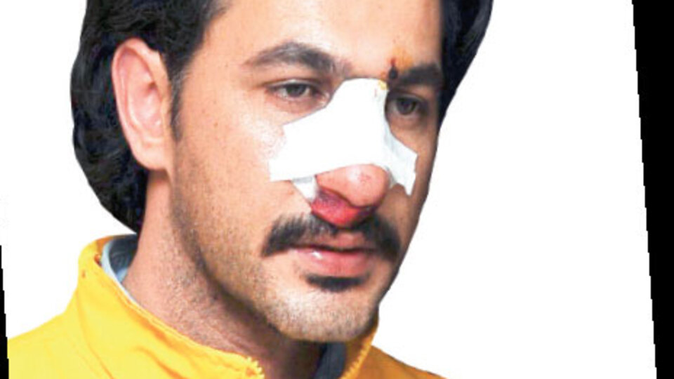 Tente canavarlığı