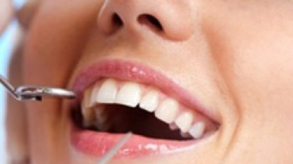 Güzel gülüşün sırrı dişlerde