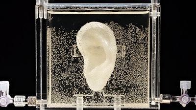 Van Gogh'un kesik kulağı yeniden yapıldı