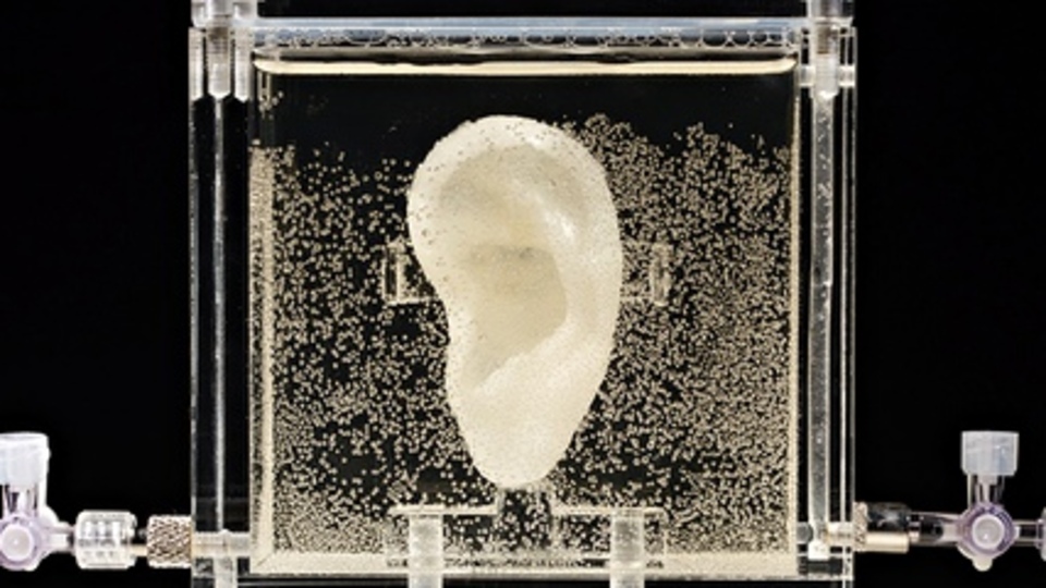 Van Gogh'un kesik kulağı yeniden yapıldı