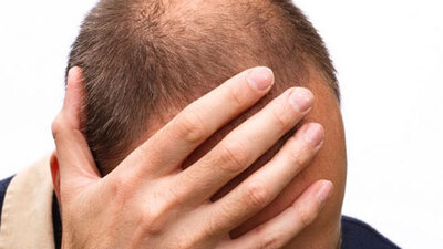 Kelliğin ilacı bulundu