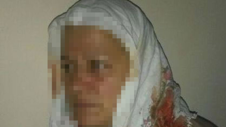 Gelininin başını balta ile yardı
