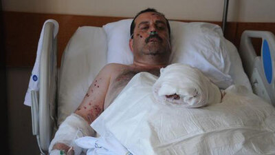 İftar topu patlatırken eli koptu