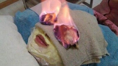 İyileşmek için bunu yapıyorlar!