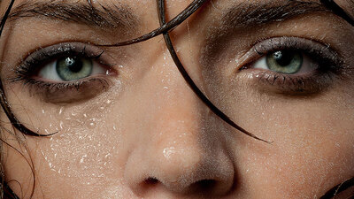 Terleme egzamayı tetikliyor