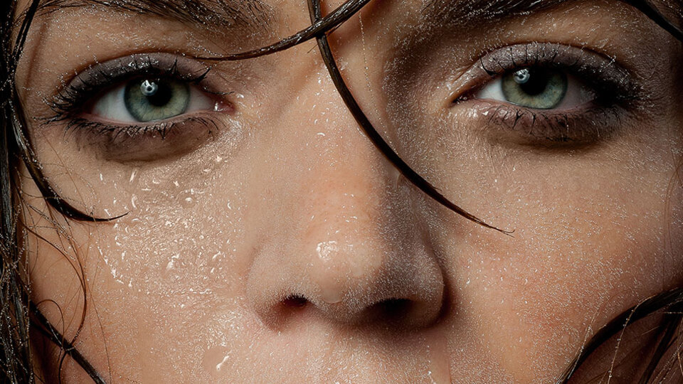 Terleme egzamayı tetikliyor