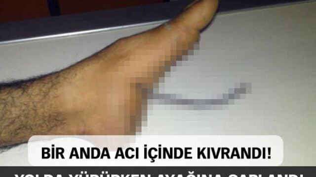 Yolda yürürken ayağına saplandı
