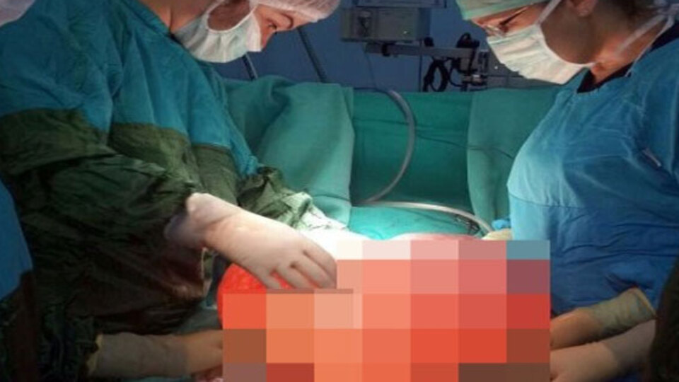 Karnından 12 kilo kist çıktı