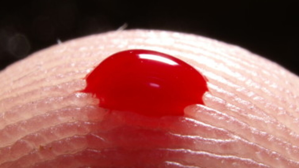 İntihar geni bulundu