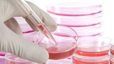 Kıkırdak hasarlarına kök hücreli çözüm