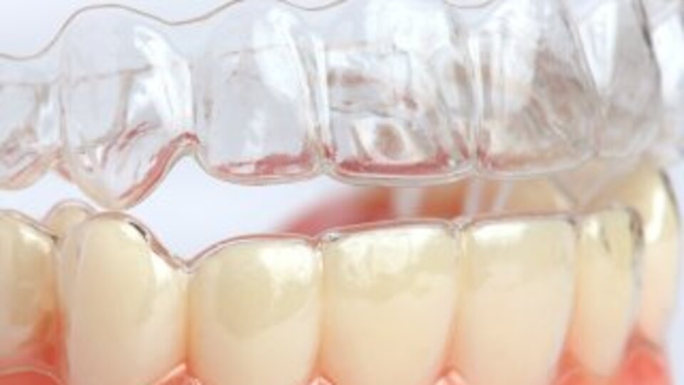 Tel takmak istemiyorsanız...