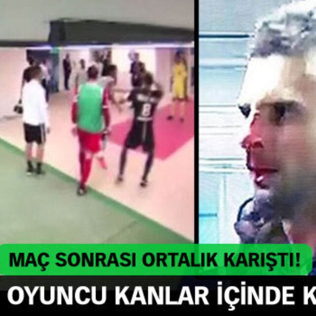 Yıldız oyuncu kanlar içinde kaldı!